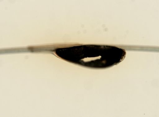 Pediculus humanus