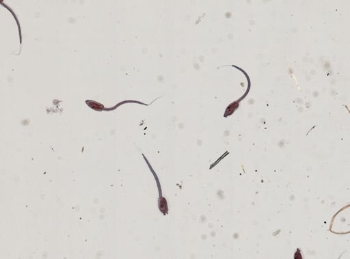 Tunicata