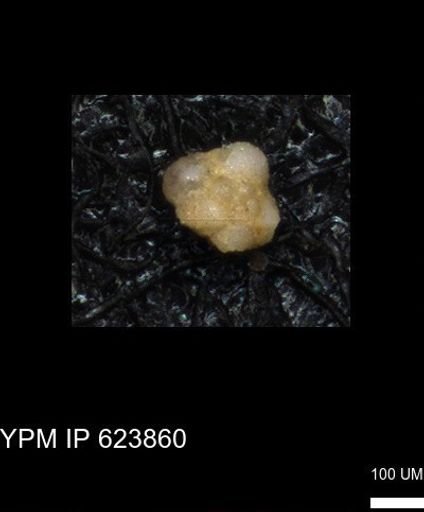 undet. Foraminiferida