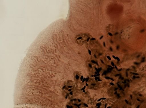 Fasciola hepatica
