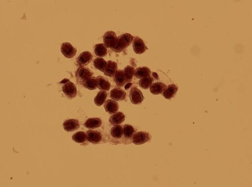 Echinococcus granulosus