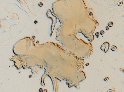 Ancula gibbosa