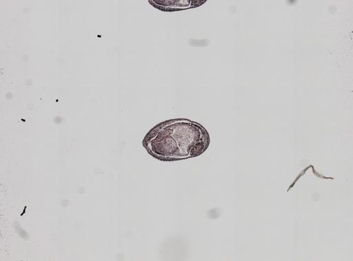 Plagiostomum whitmani