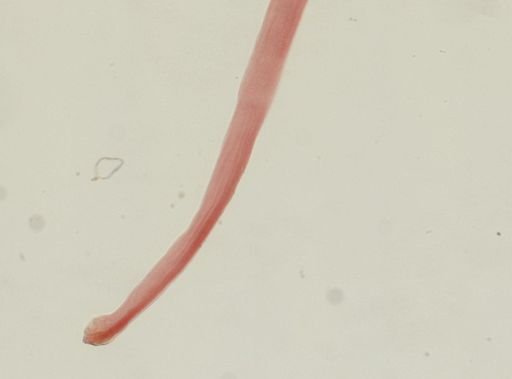 Hymenolepis diminuta
