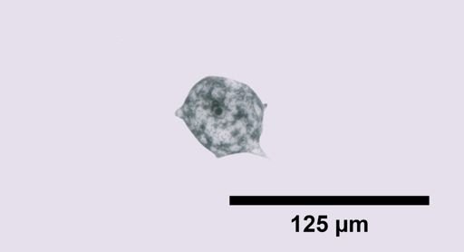 Amoeba radiosa