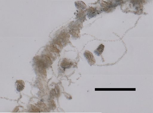 Hippopodius hippopus
