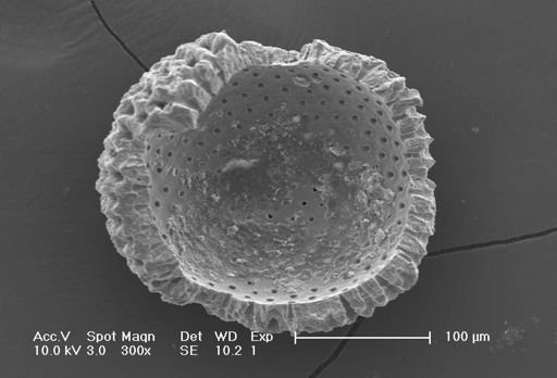 Globigerinoides sacculifer