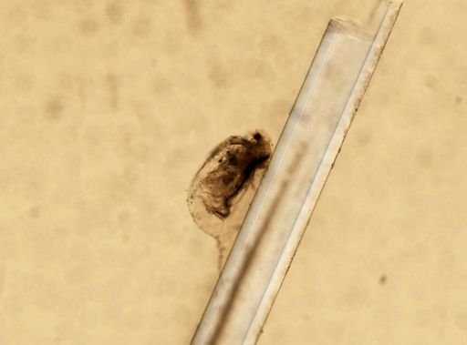 Daphnia pulex