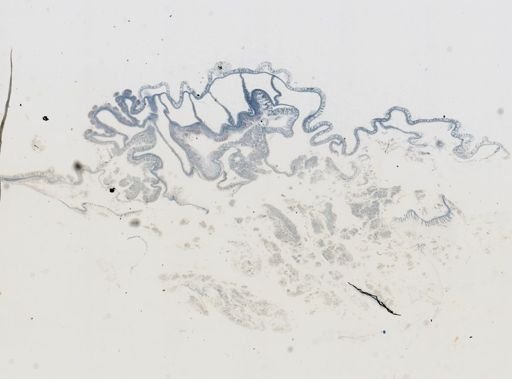 Astrangia poculata