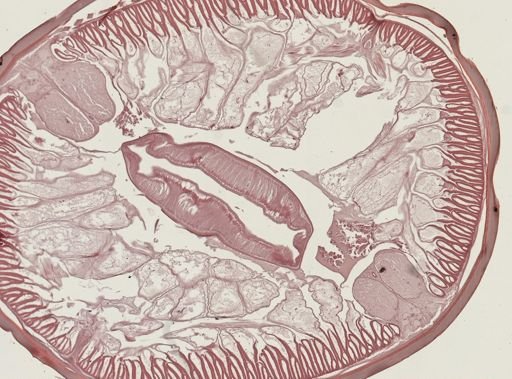 Ascaris lumbricoides
