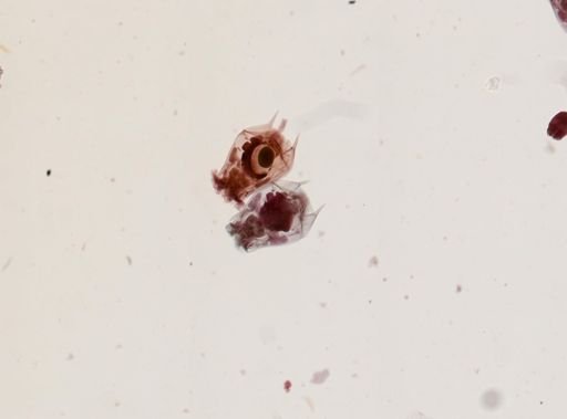 Brachionus