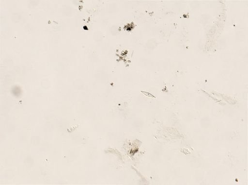 Urocentrum