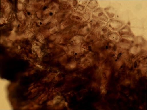 Alcyonidium
