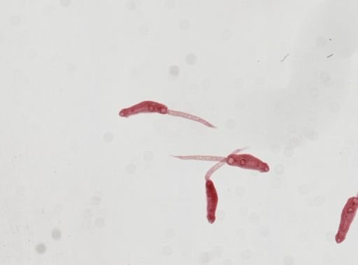 Echinostoma revolutum