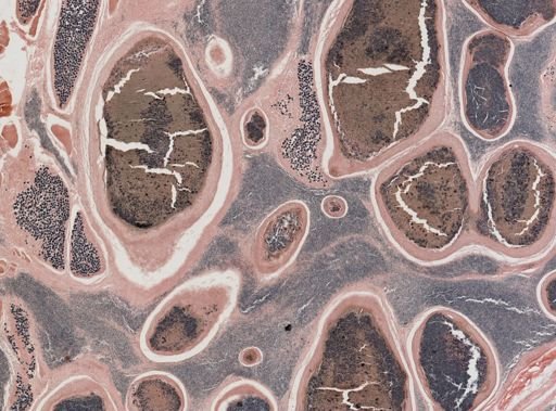 Ichthyosporidium