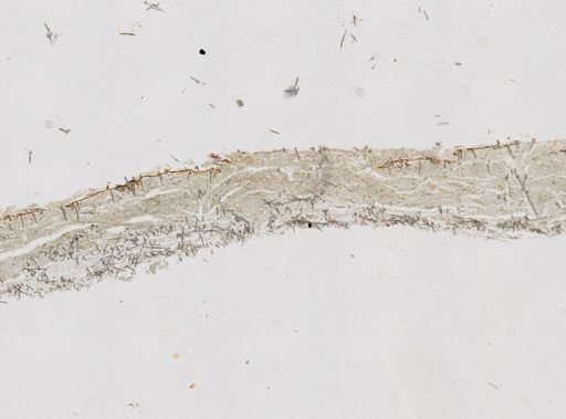 Clathria (Thalysias) eurypa