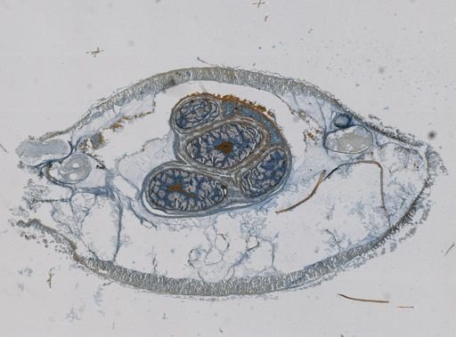 Paradinonemertes drygalskii