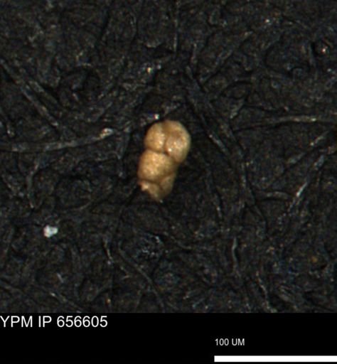 Verneuilina canadensis
