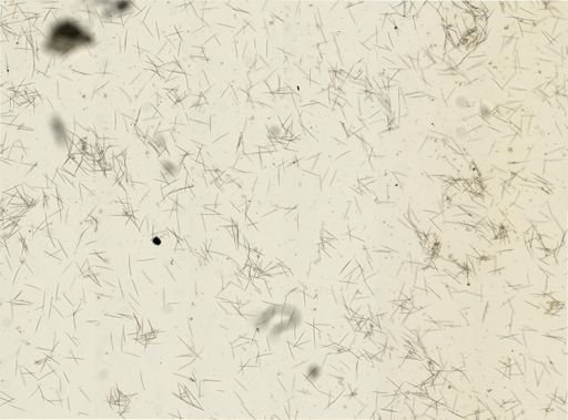 Chalinula loosanoffi