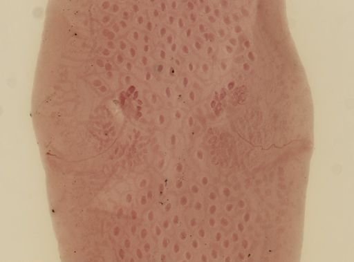 Dipylidium caninum