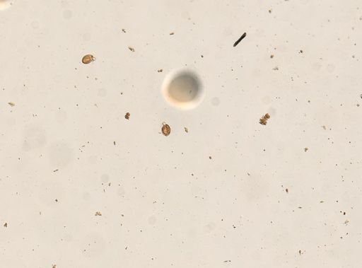 Diphyllobothrium canis