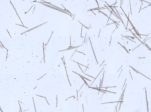 Prosuberites sp.