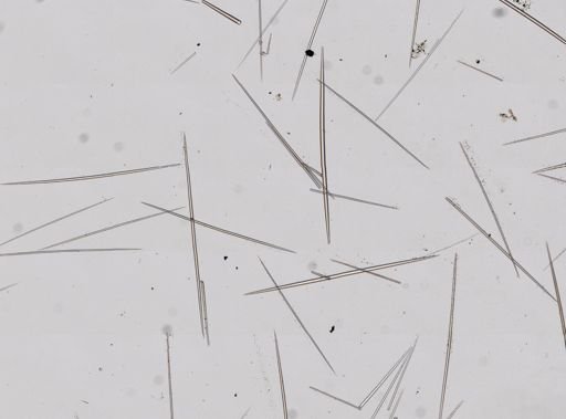 Halichondriidae?