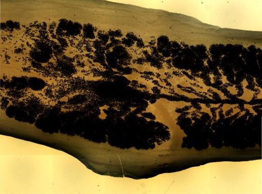Taenia saginata