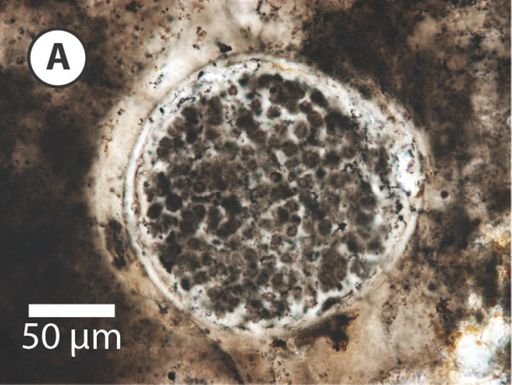 Megasphaera miniscula