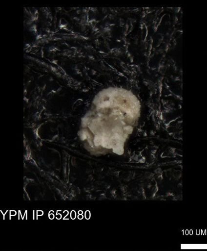 undet. Foraminiferida