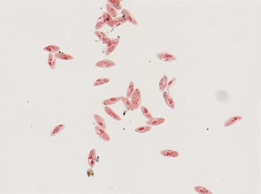 Paramecium calkinsi