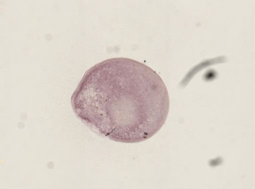 Otobothrium crenacolle