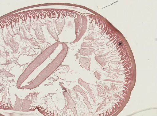 Ascaris lumbricoides