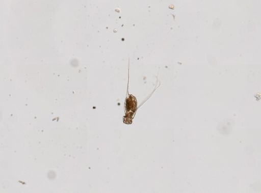 Filinia longiseta