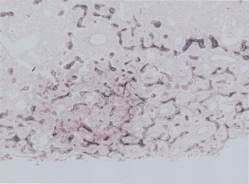 Ostrea?