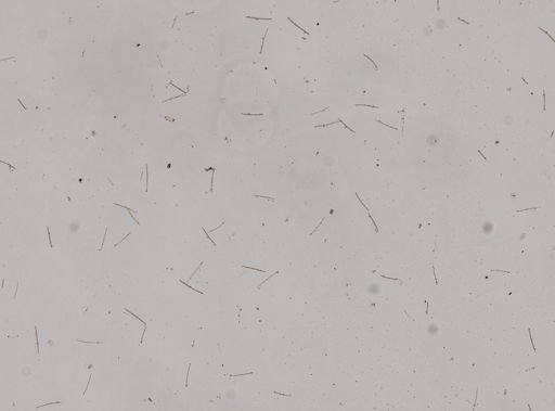 Haliclona