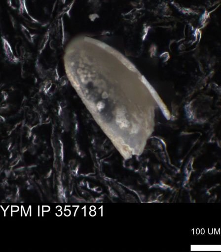 undet. Ostracoda