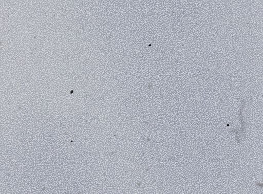 Plasmodium vivax