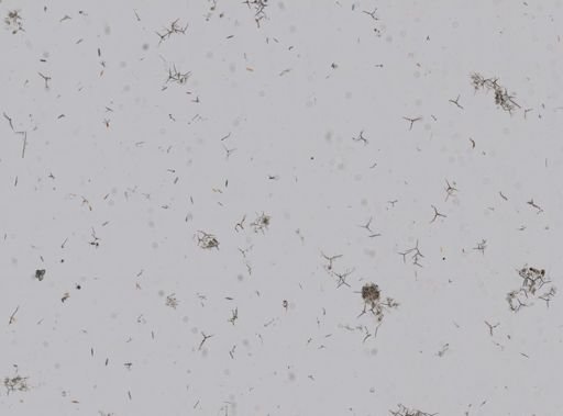Leucosolenia cancellata