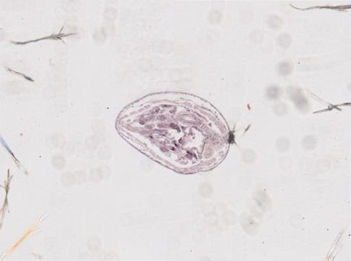 Cambarincola vitreus