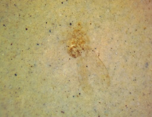 undet. Hexapoda