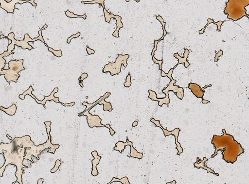 Giardia lamblia