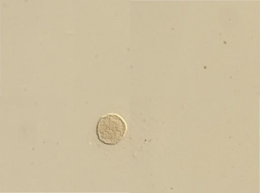 Branchiostoma