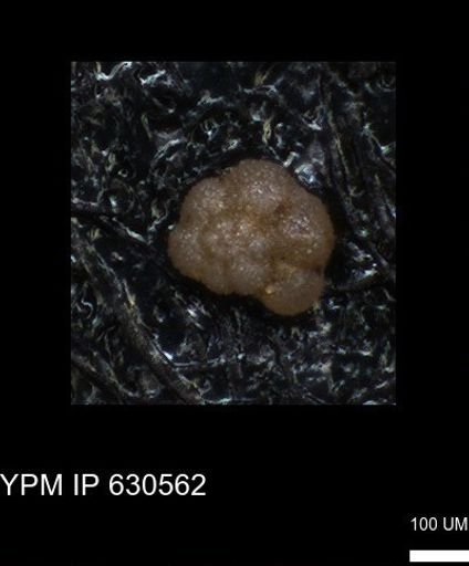 undet. Rugoglobigerinidae