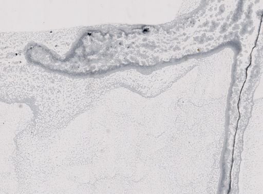 Microsporidia