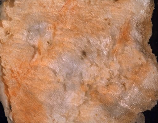 Trypostega claviculata