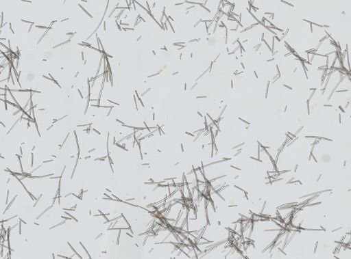 Xestospongia sp.