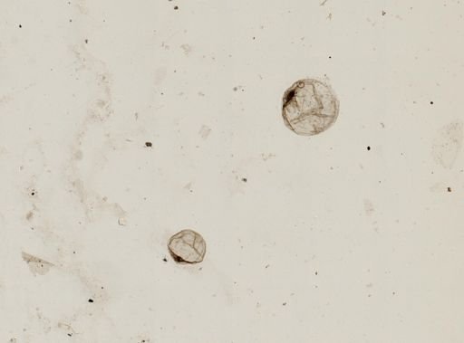 Noctiluca