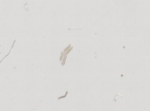 Hydrobia glabra