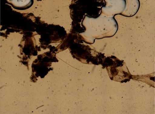 Hislopia corderoi
